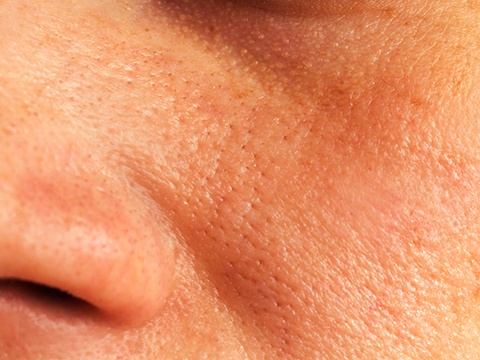 鼻の毛穴黒ずみを解消 角栓除去におすすめの洗顔料とスキンケア方法 スキンケア大学