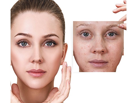 顔のくすみの原因と対策 改善方法 おすすめの化粧品で透明感ある肌に スキンケア大学