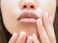 唇がカサカサ乾燥で痛くなる原因と治し方！効果のある美容アイテムも紹介